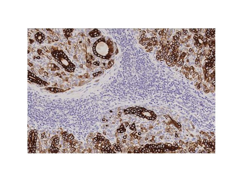 Novocastra HD – Head & Neck Pathology