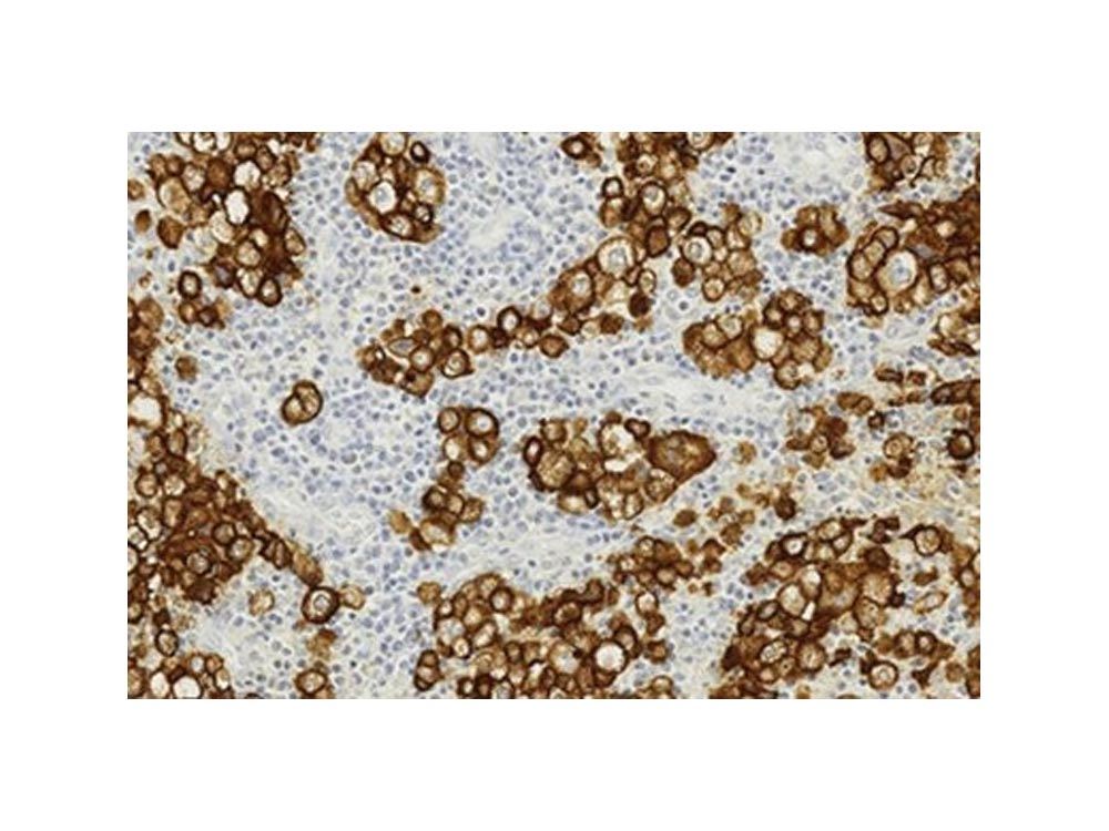 Novocastra HD - Dermatopathology
