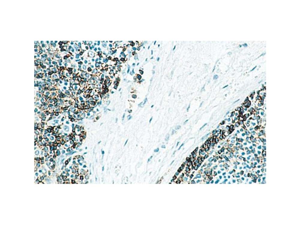 Novocastra HD – Hematopathology