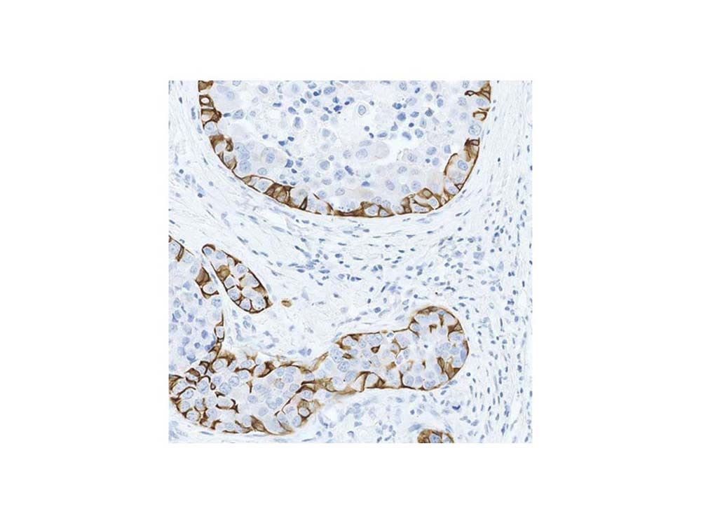 Novocastra Primary Antibodies