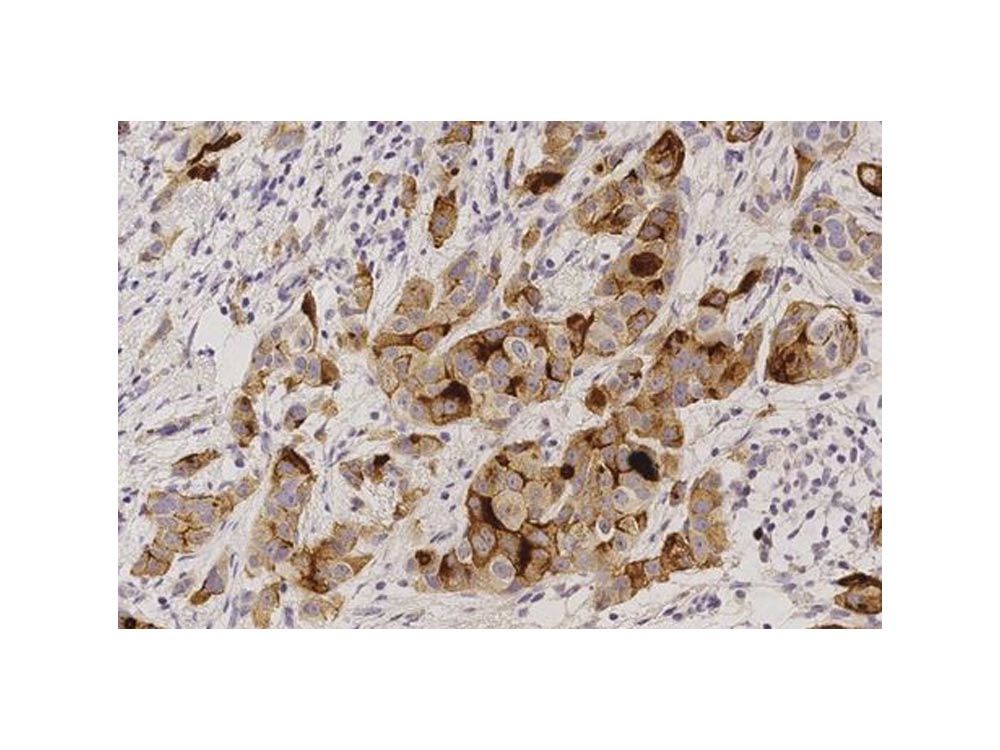 Novocastra HD – Breast Pathology