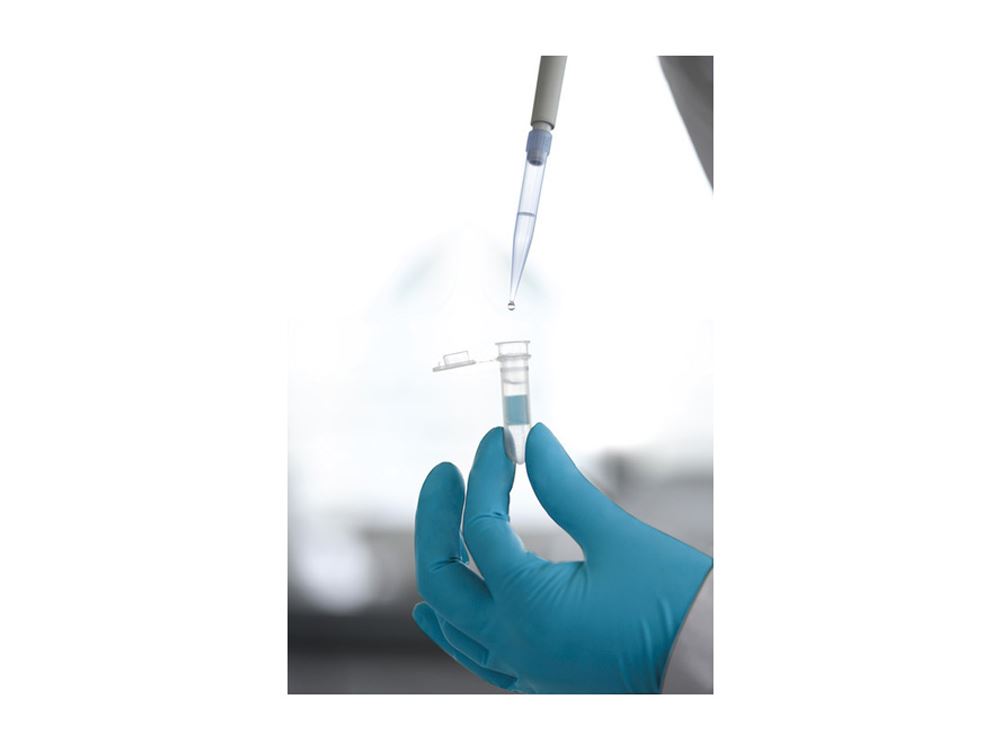 Chromatography